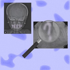 teeth