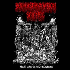 Space Adaptation Syndrome