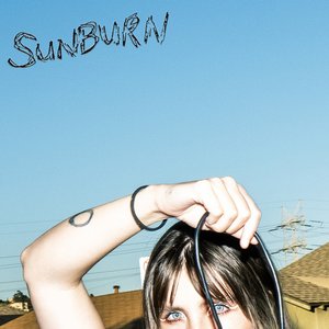Sunburn
