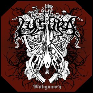 Malignancy