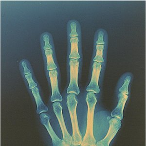 These Old Bones