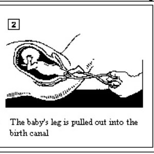 My Abortion's Momma