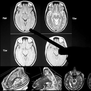 Toward a Unified Science of the Mind​-​Brain
