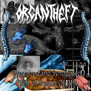 Organized and Syndicated Theft of Human Organs