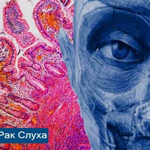 Image for 'Рак Слуха'