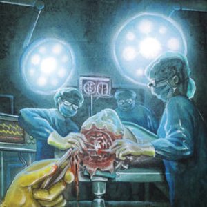 Brain Surgery