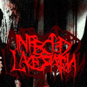 Infected Laceration için avatar