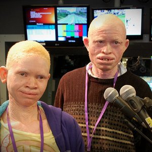 Avatar for Tanzania Albinism Collective