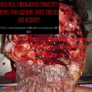 Post-Traumatic Hemorrhagic Erosion from Failed Surgical Reconstruction