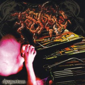 Dyspartum