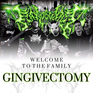 Avatar for GINGIVECTOMY