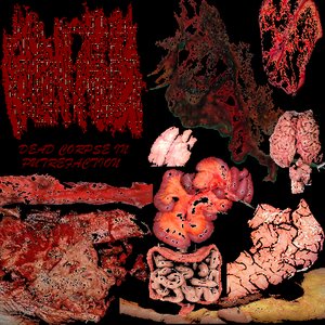 Dead Corpse In Putrefaction