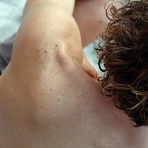 Freckles - Single