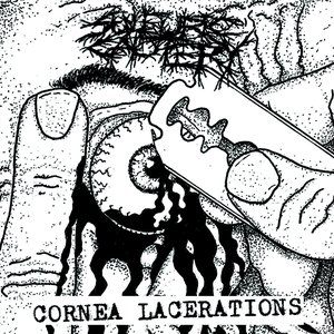 Cornea Lacerations