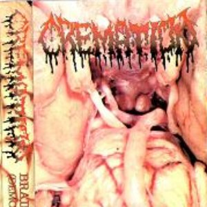 Braindeath