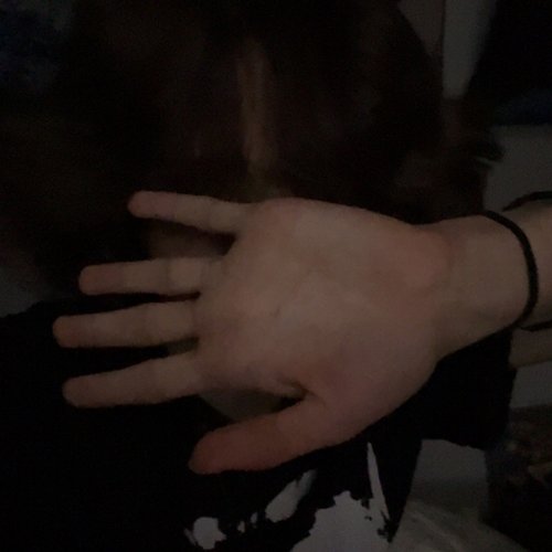 ADHD