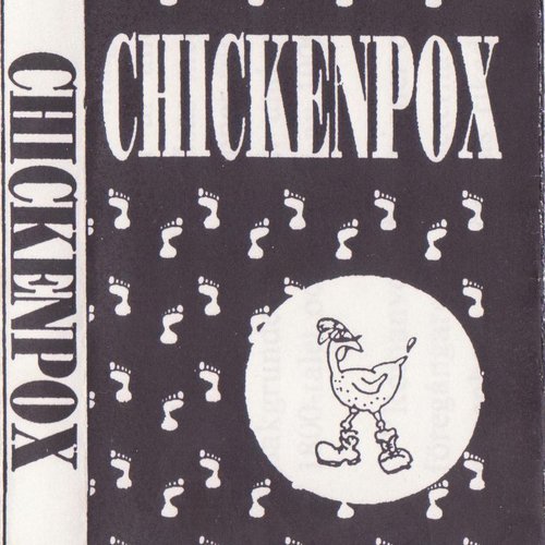 Chickenpox