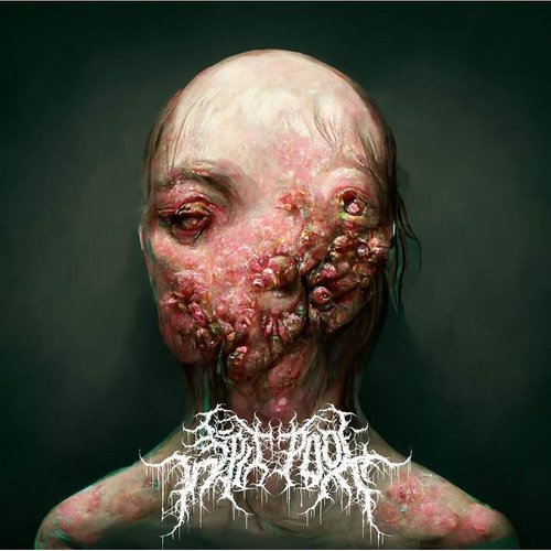 Gonoclam - Single