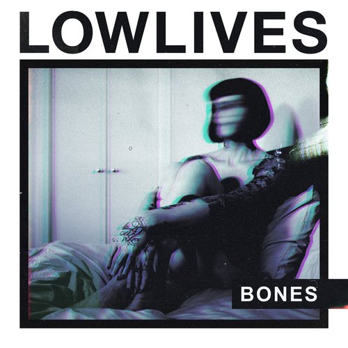 Bones