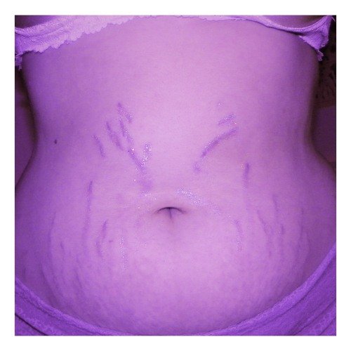 Diet Culture (Stripped) - Single