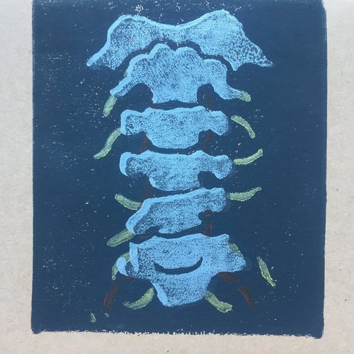 C4C5