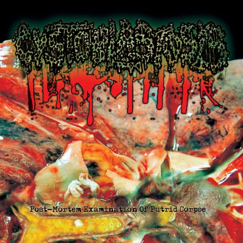 Post-Mortem Examination Of Putrid Corpse