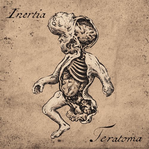 Teratoma