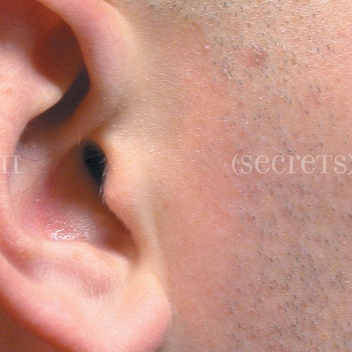Secrets pt. 2