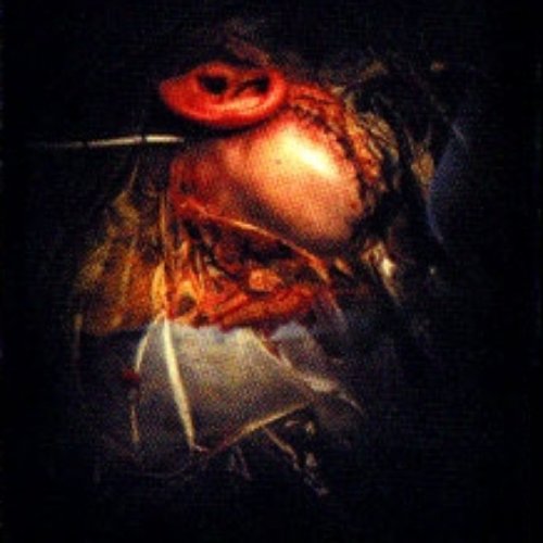 Homicidal Intent