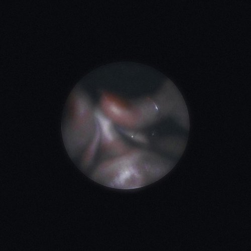 SATELLITE