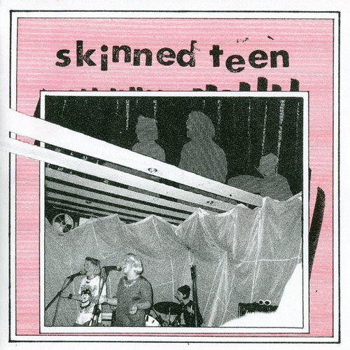 Skinned Teen