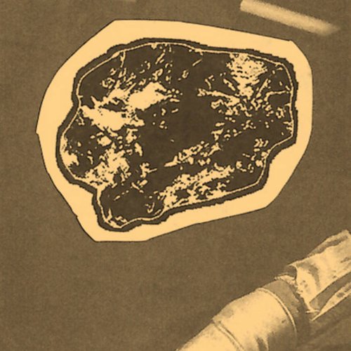 Radical Nephrectomy