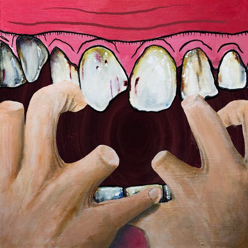 Observer [Explicit]