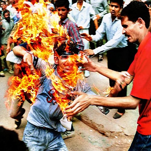I Wanna Be a Burn Victim