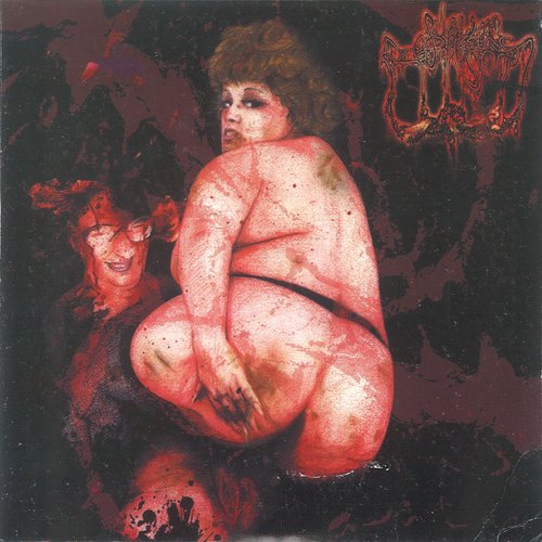 Serum Sickness Syndrome / Sublime Cadaveric Decomposition