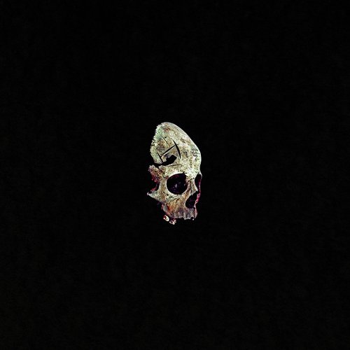 Surgical Opening in the Skull