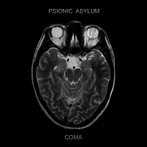 Coma