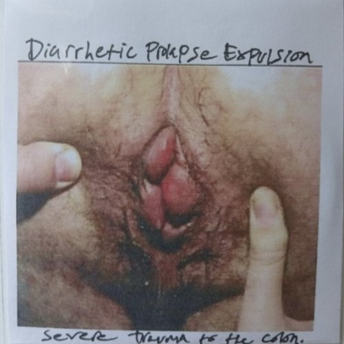 Severe Trauma to the Colon