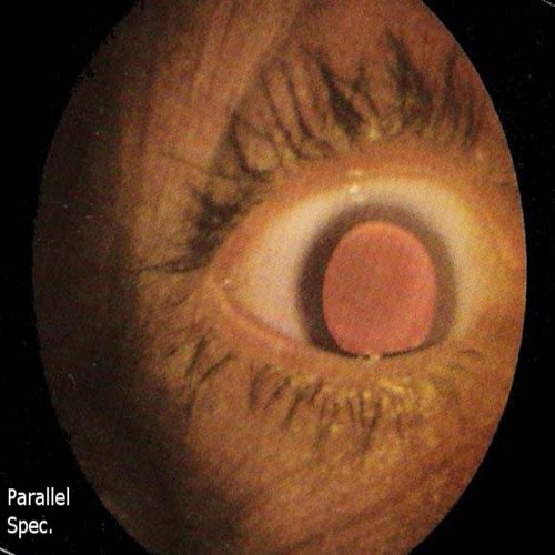 Atomic Bomb Cataract Demo