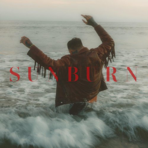 Sunburn