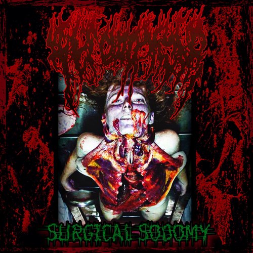 Surgical Sodomy