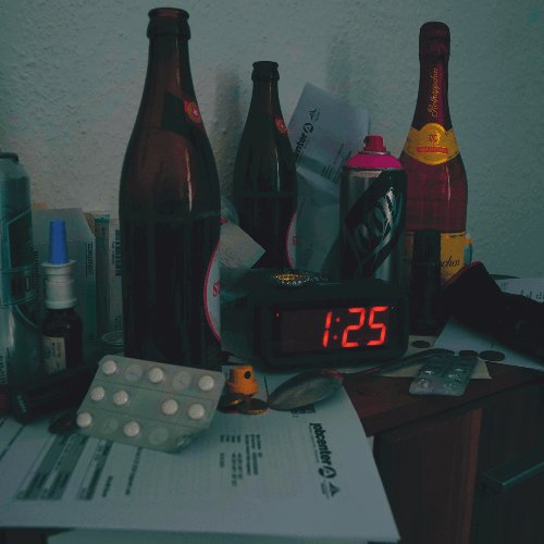 1:25