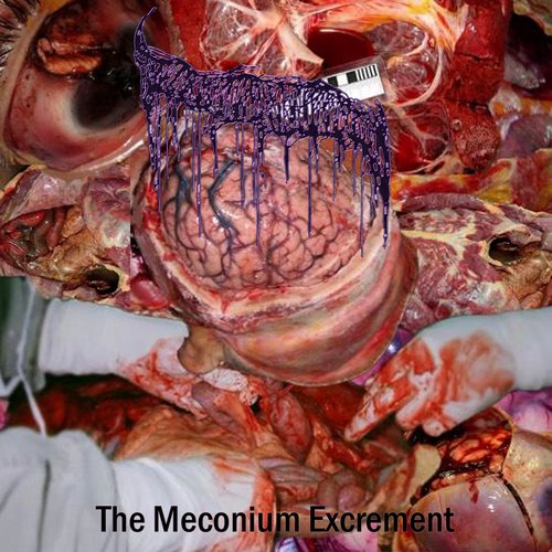 The Meconium Excrement