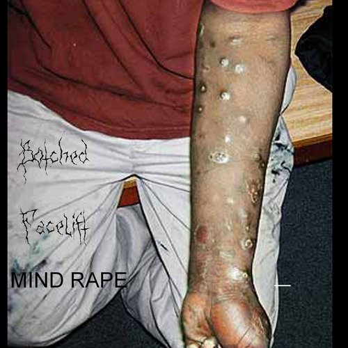 Mind Rape