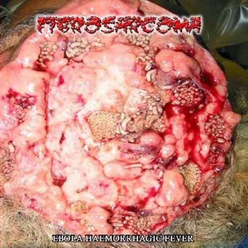 Ebola Haemorrhagic Fever