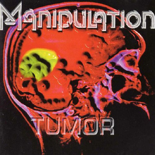 Tumor