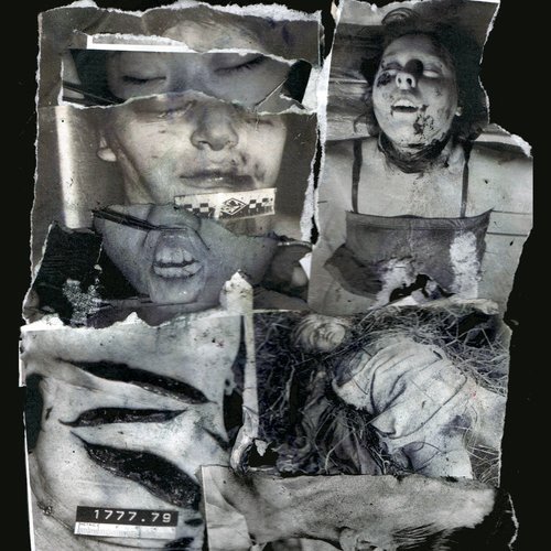Infibulation