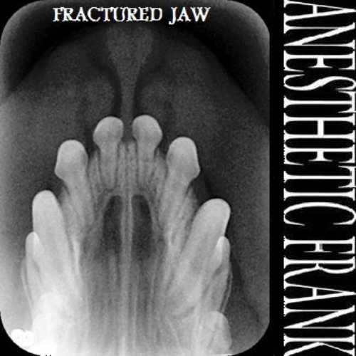Fractured Jaw EP