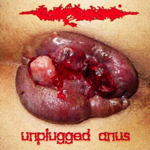 Unplugged Anus