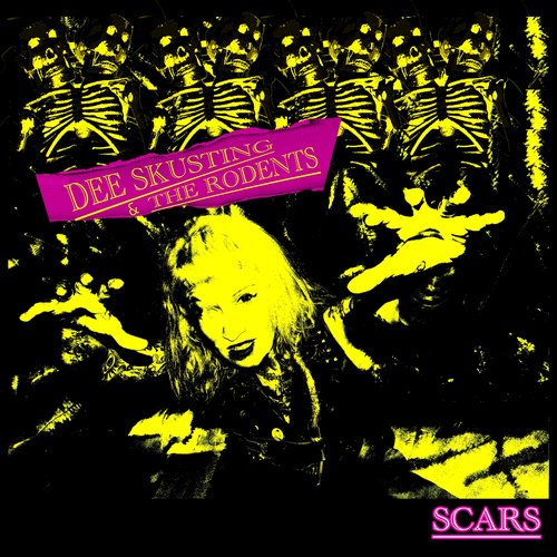 Scars